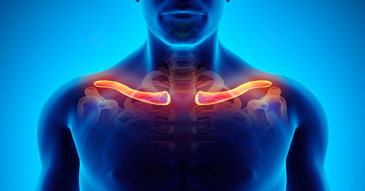 Clavicle fractures can be stabilized through a limited incision technique due to new low profile anatomical plates.